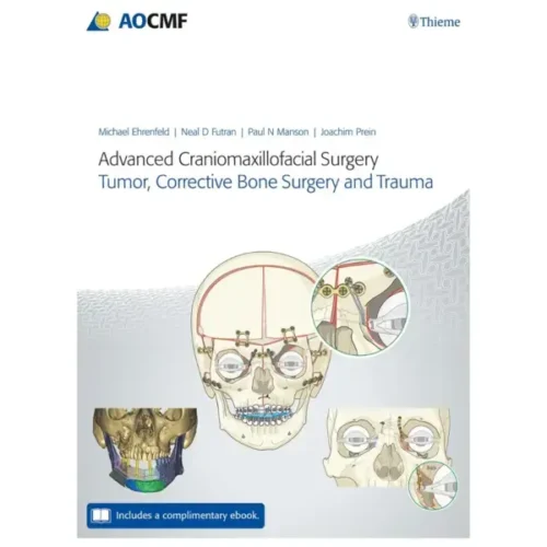 Advanced Craniomaxillofacial Sur Advanced Craniomaxillofacial Surgery: Tumor, Corrective Bone Surgery, and Trauma