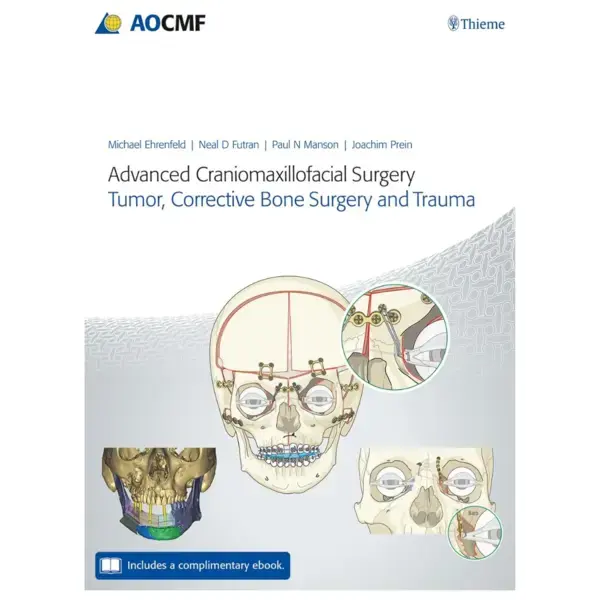 Advanced Craniomaxillofacial Sur Advanced Craniomaxillofacial Surgery: Tumor, Corrective Bone Surgery, and Trauma