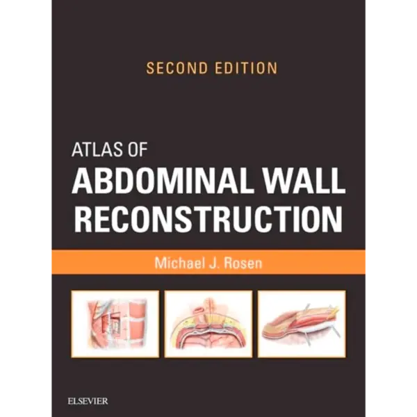 Atlas of Abdominal Wall Reconstruction: Atlas of Abdominal Wall Reconstruction (Original PDF & Videos)