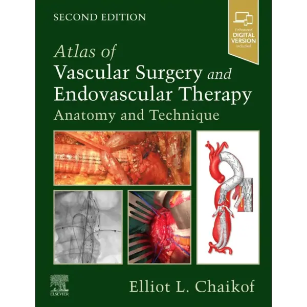 Atlas of Vascular Surgery and En Atlas of Vascular Surgery and Endovascular Therapy: Anatomy and Technique