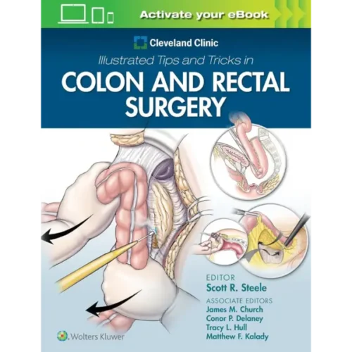 Cleveland Clinic Illustrated Tip Cleveland Clinic Illustrated Tips and Tricks in Colon and Rectal Surgery