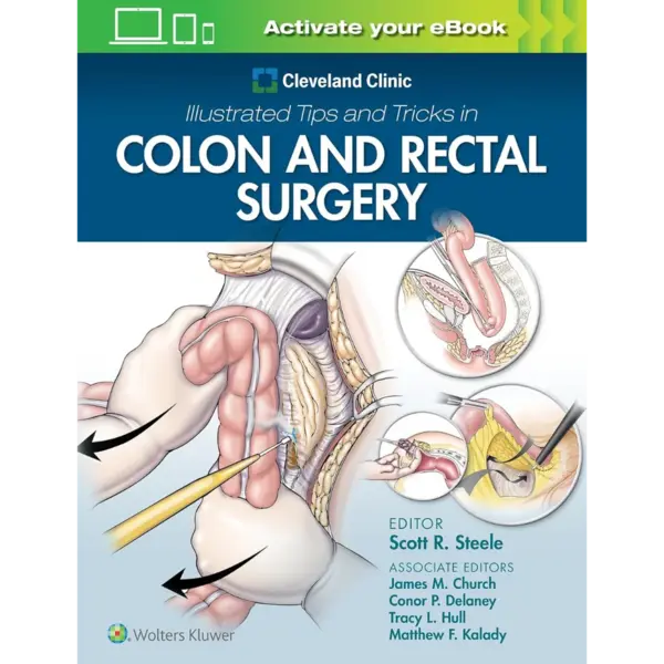 Cleveland Clinic Illustrated Tip Cleveland Clinic Illustrated Tips and Tricks in Colon and Rectal Surgery