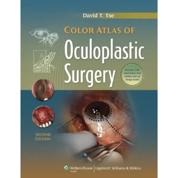 Color Atlas of Oculoplastic Surg Color Atlas of Oculoplastic Surgery