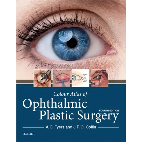 Colour Atlas of Ophthalmic Plast Colour Atlas of Ophthalmic Plastic Surgery