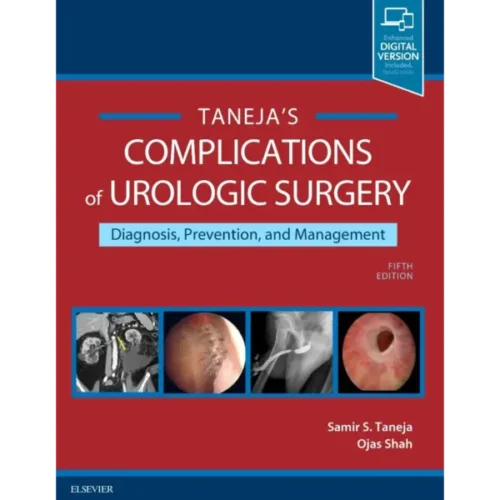 Complications of Urologic Surgery: Prevention and Management