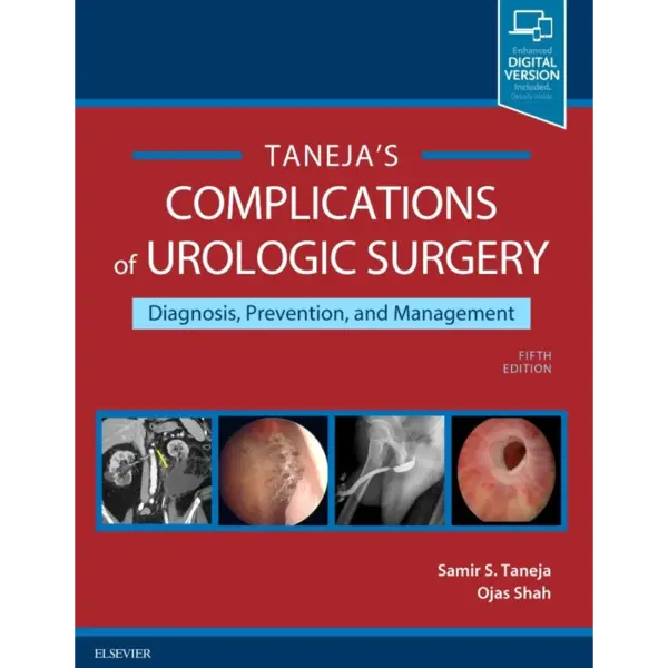 Complications of Urologic Surger Complications of Urologic Surgery: Prevention and Management