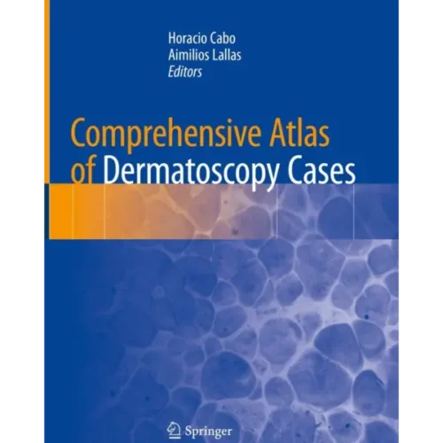 Comprehensive Atlas of Dermatosc Comprehensive Atlas of Dermatoscopy Cases