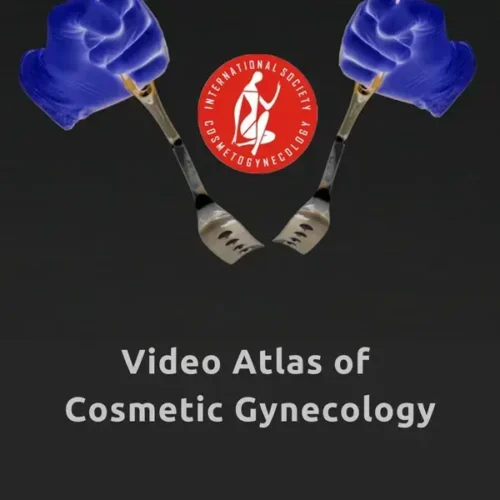 ISCG Video Atlas of Cosmetic Gyn ISCG Video Atlas of Cosmetic Gynecology