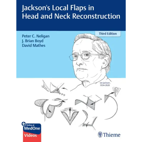 Jackson’s Local Flaps in Head and Neck Reconstruction