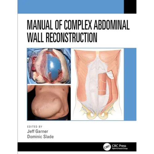 Manual of Complex Abdominal Wall Manual of Complex Abdominal Wall Reconstruction