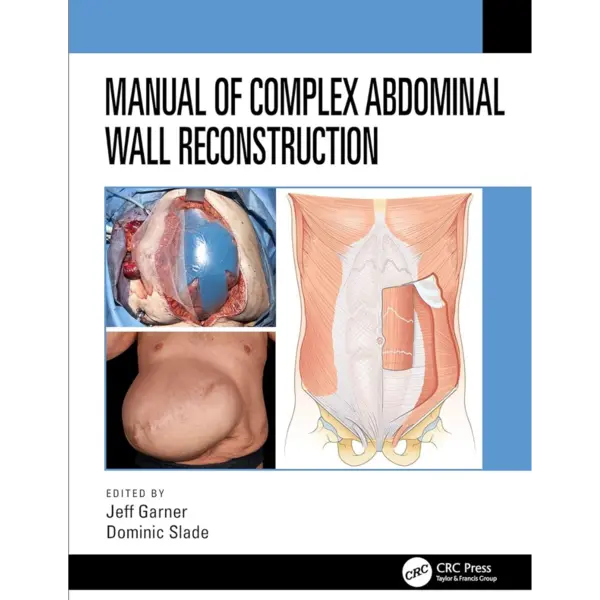 Manual of Complex Abdominal Wall Reconstruction