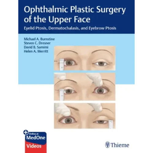 Ophthalmic Plastic Surgery of th Ophthalmic Plastic Surgery of the Upper Face: Eyelid Ptosis, Dermatochalasis, and Eyebrow Ptosis Original PDF & Videos)