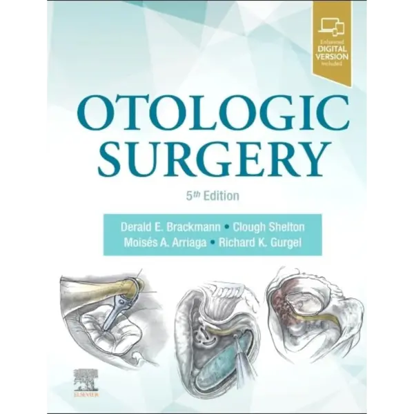 Otologic Surgery (Original PDF & Videos)