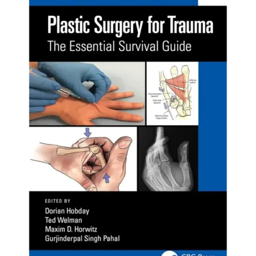 Plastic Surgery for Trauma- The Plastic Surgery for Trauma: The Essential Survival Guide