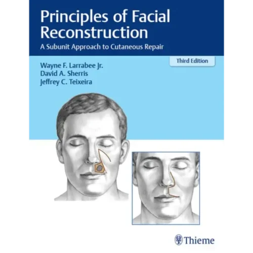 Principles of Facial Reconstruct Principles of Facial Reconstruction: A Subunit Approach to Cutaneous Repair