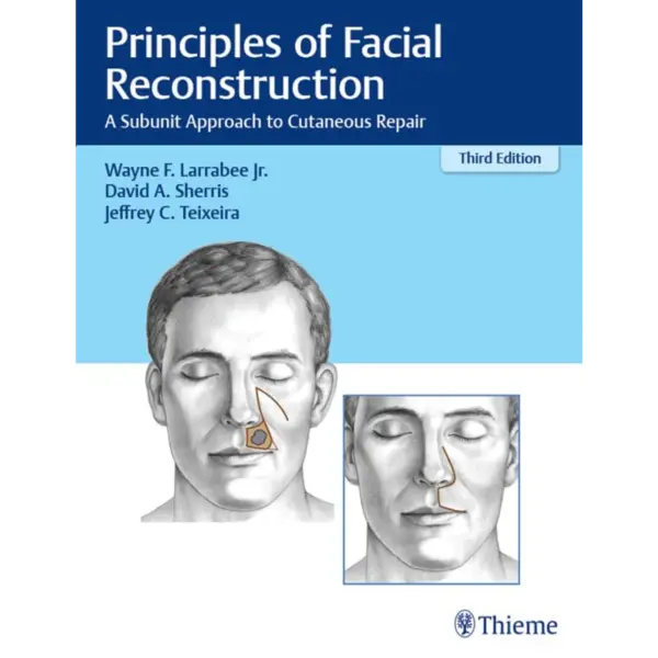 Principles of Facial Reconstruct Principles of Facial Reconstruction: A Subunit Approach to Cutaneous Repair