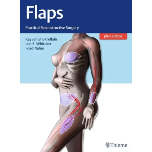 Private- Flaps- Practical Recons Flaps: Practical Reconstructive Surgery (Original PDF & Videos)