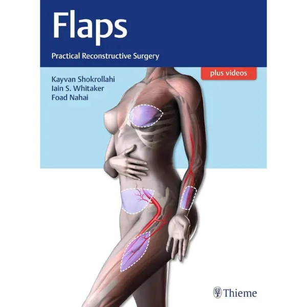 Private- Flaps- Practical Recons Flaps: Practical Reconstructive Surgery (Original PDF & Videos)