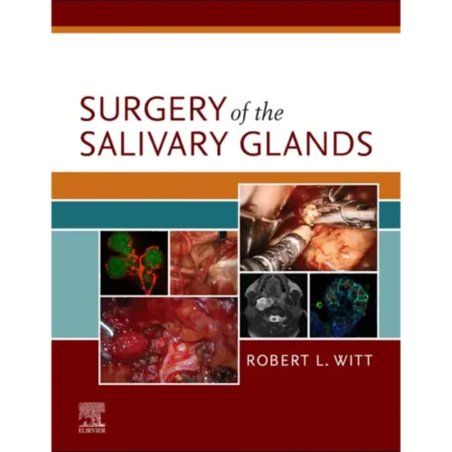 Surgery of the Salivary Glands (1) Surgery of the Salivary Glands