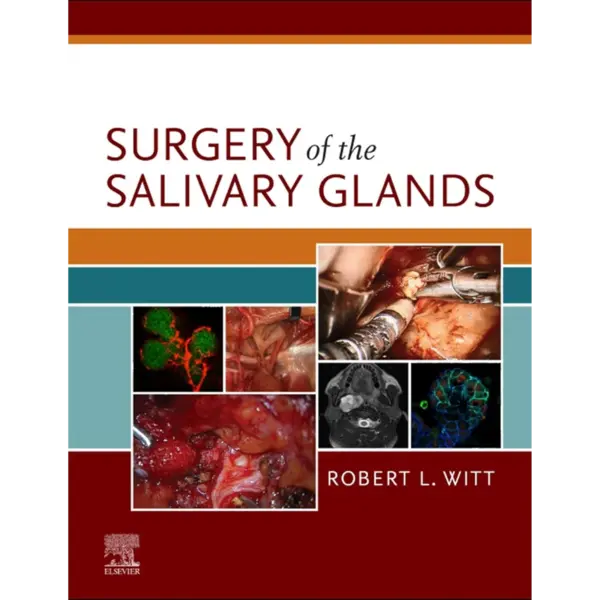 Surgery of the Salivary Glands (1) Surgery of the Salivary Glands