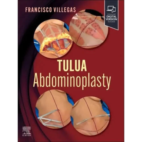 TULUA Abdominoplasty- Transverse TULUA Abdominoplasty: Transverse Plication Technique