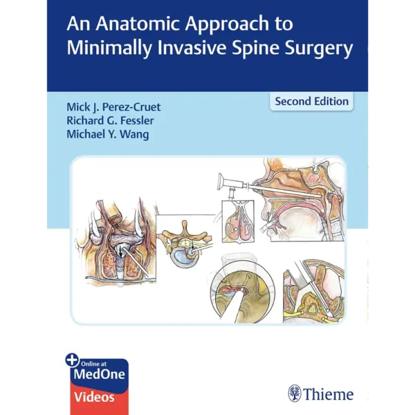 An Anatomic Approach to Minimally Invasive Spine Surgery