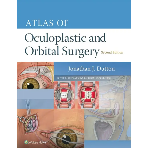 Atlas of Oculoplastic and Orbita Atlas of Oculoplastic and Orbital Surgery