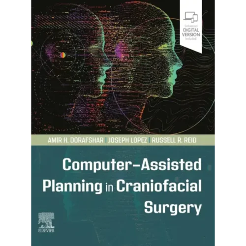 Computer-Assisted Planning in Cr Computer-Assisted Planning in Craniofacial Surgery