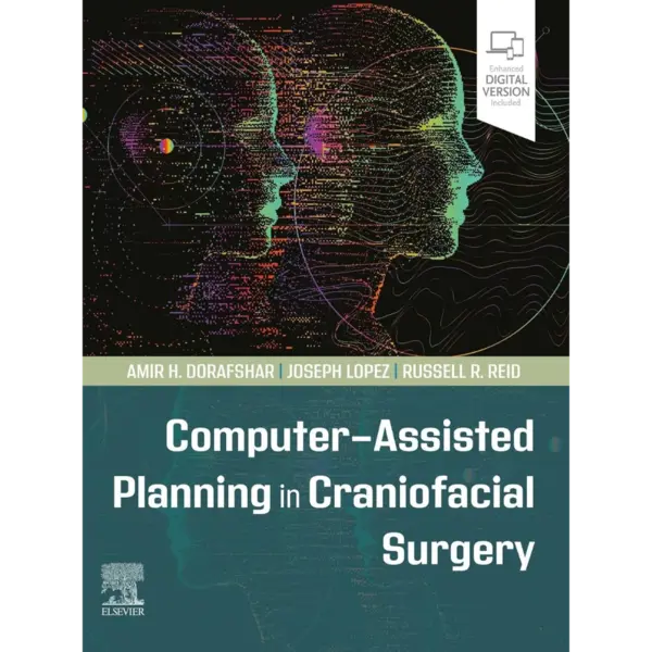 Computer-Assisted Planning in Cr Computer-Assisted Planning in Craniofacial Surgery