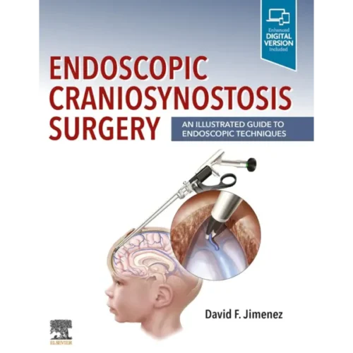 Endoscopic Craniosynostosis Surg Endoscopic Craniosynostosis Surgery: An Illustrated Guide to Endoscopic Techniques
