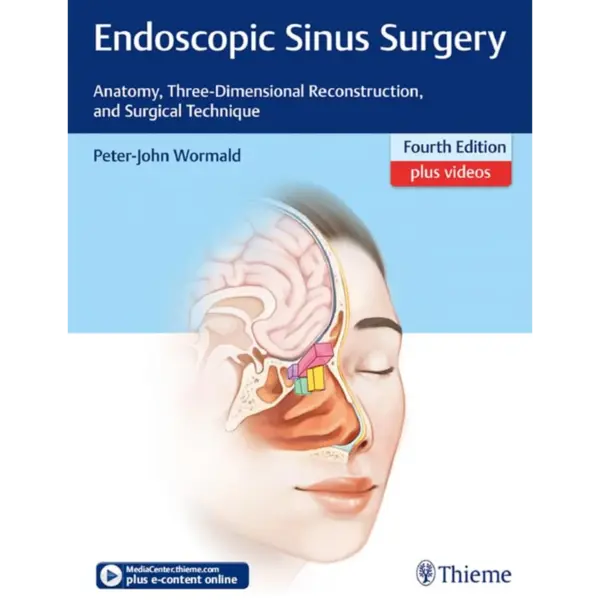 Endoscopic Sinus Surgery: Anatomy, Three-Dimensional Reconstruction, and Surgical Technique