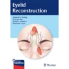 Eyelid Reconstruction