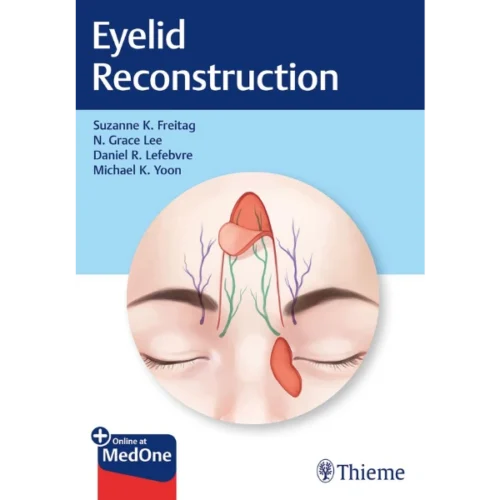 Eyelid-Reconstruction Eyelid Reconstruction