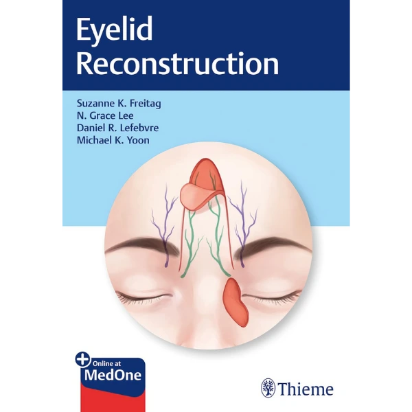 Eyelid Reconstruction