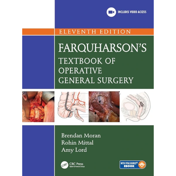 Farquharson's Textbook of Operative General Surgery