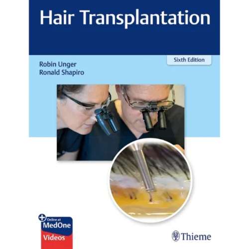 Hair-Transplantation Hair Transplantation
