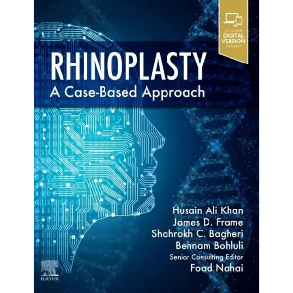 Rhinoplasty- a Case-based approa Rhinoplasty: a Case-based approach