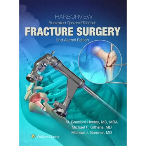Harborview Illustrated Tips and Tricks in Fracture Surgery
