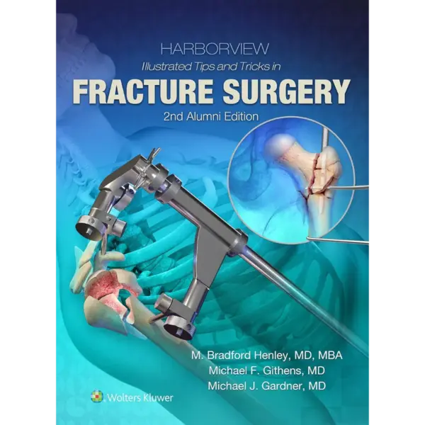 Harborview Illustrated Tips and Harborview Illustrated Tips and Tricks in Fracture Surgery