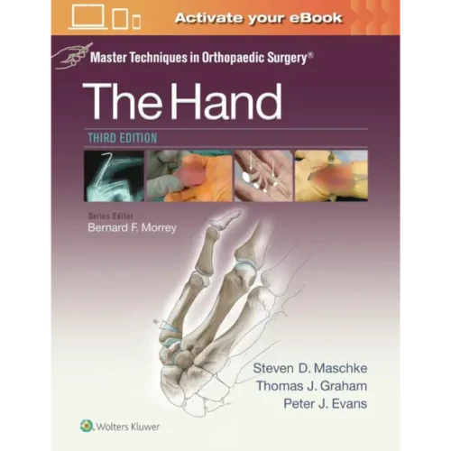 Master Techniques in Orthopaedic (1) Master Techniques in Orthopaedic Surgery: The Hand