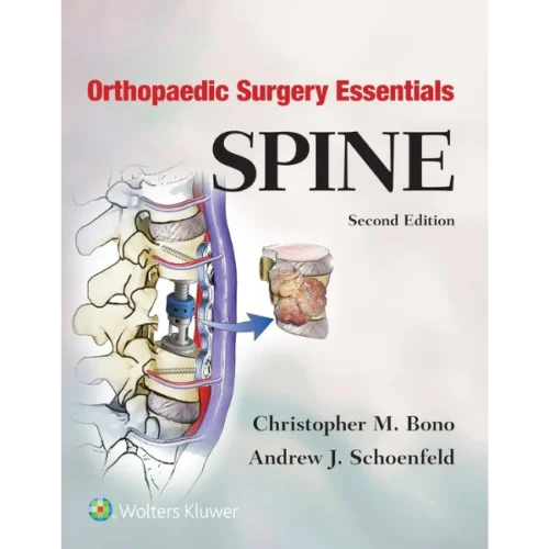 Orthopaedic Surgery Essentials: Spine