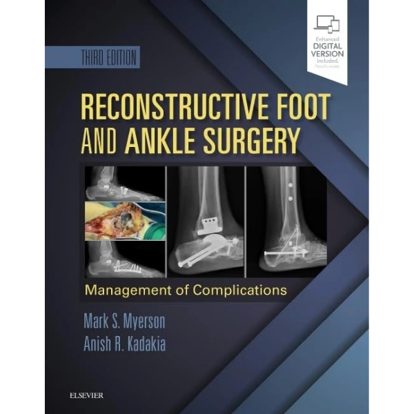 Reconstructive Foot and Ankle Surgery Management of Complications Reconstructive Foot and Ankle Surgery: Management of Complications (Original PDF & Videos)