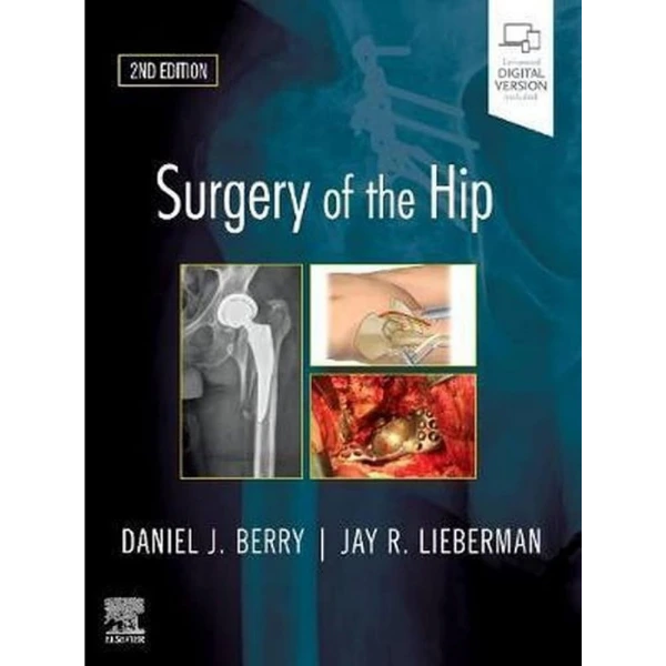 Surgery of the Hip Surgery of the Hip
