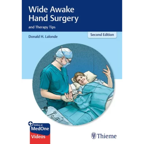 Wide Awake Hand Surgery and Therapy Tips